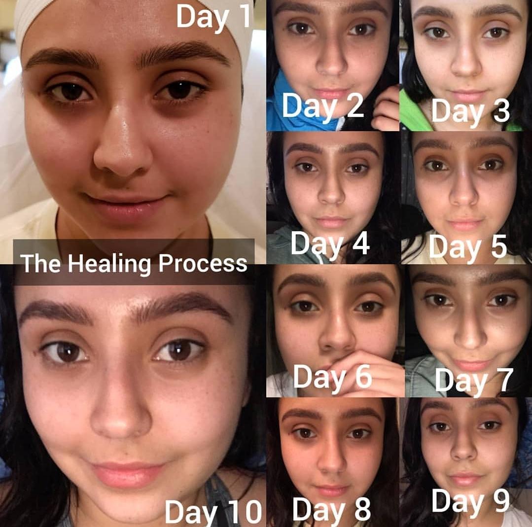 Microblading Beauty Bar, mia bella salon call now 408-518-9222 Microblading Beauty Bar, mia bella salon call now 408-518-9222